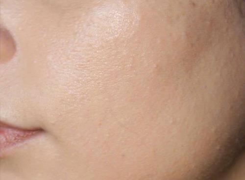 Dịch vụ chăm sóc da chuyên sâu