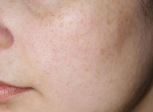 Dịch vụ chăm sóc da chuyên sâu